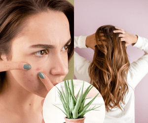 aloevera plant and a girl with pimple on left and girl with long hair on right.